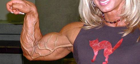 Sling reccomend vascular female muscle